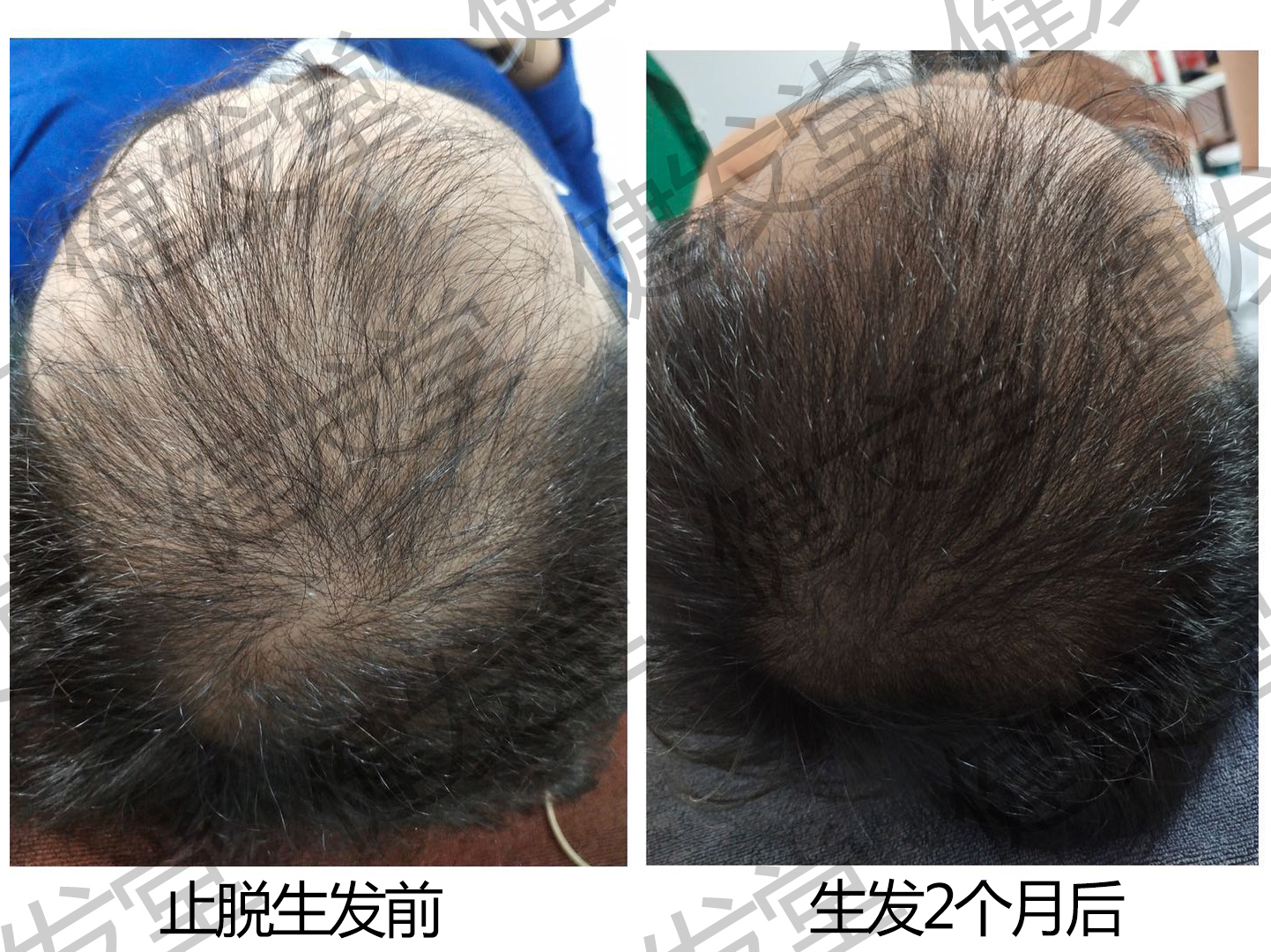 长春生发馆