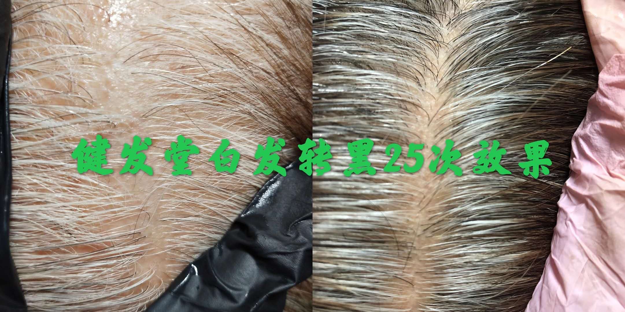 长春养发馆